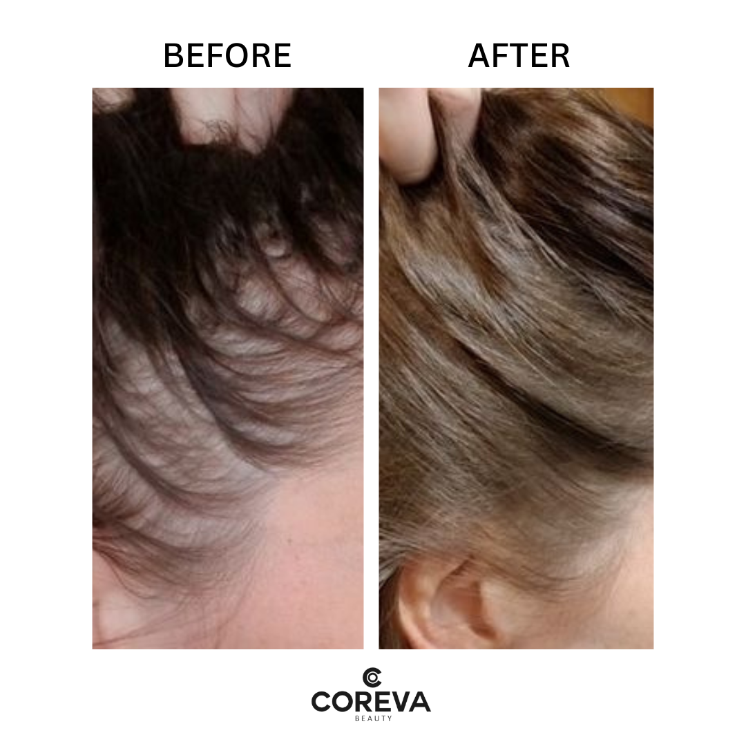 ROOTS TO ENDS RESCUER - Hair Growth Oil