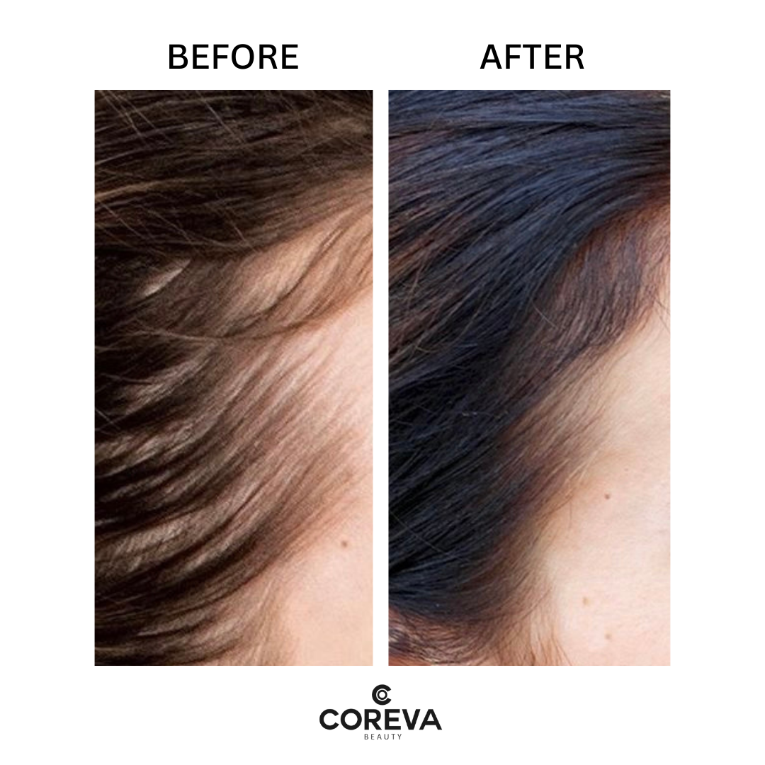 ROOTS TO ENDS RESCUER - Hair Growth Oil