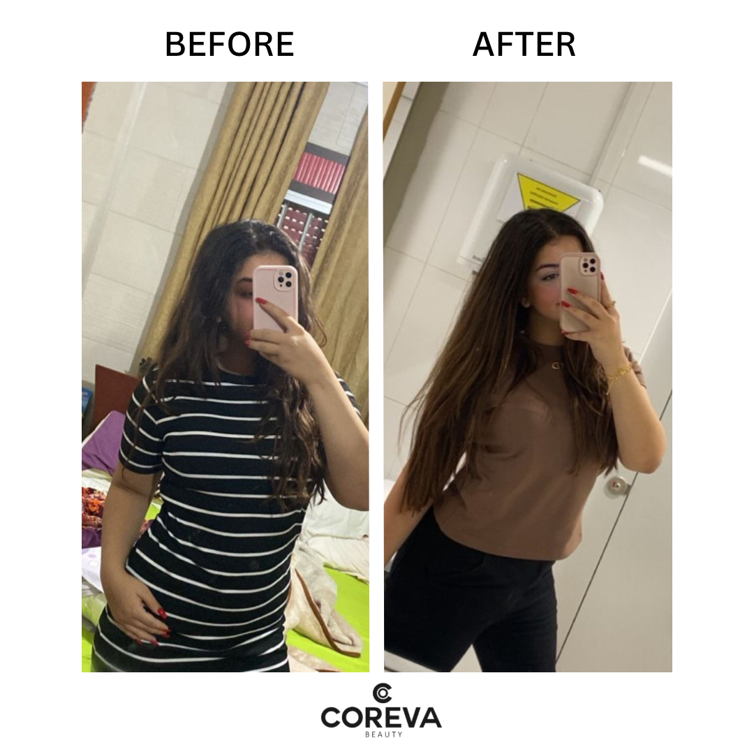 ROOTS TO ENDS RESCUER - Hair Growth Oil