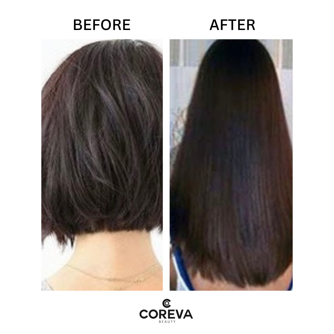 ROOTS TO ENDS RESCUER - Hair Growth Oil