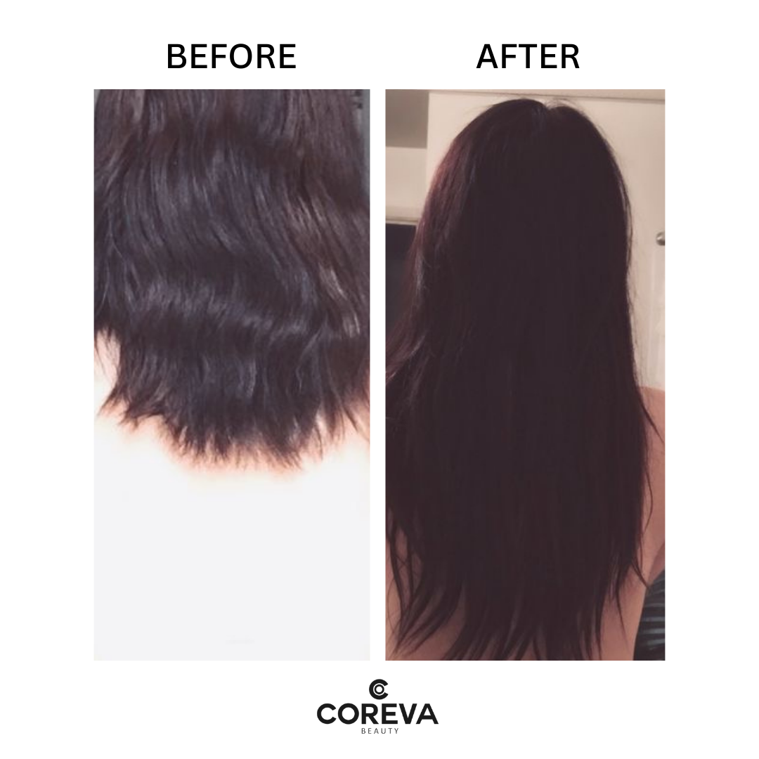 ROOTS TO ENDS RESCUER - Hair Growth Oil